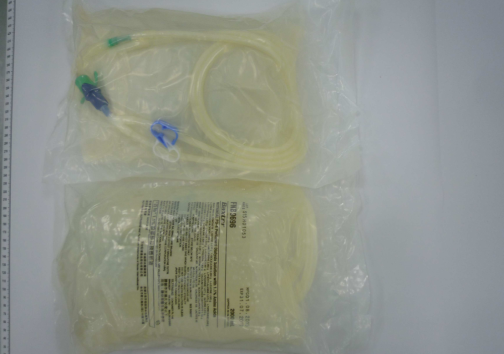 短管瑕疵異常「漏液」！4款洗腎用腹膜透析液  近5萬包回收
