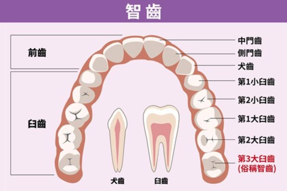 【有影】拔智齒趁年輕 放任不管小心造成健康威脅 5