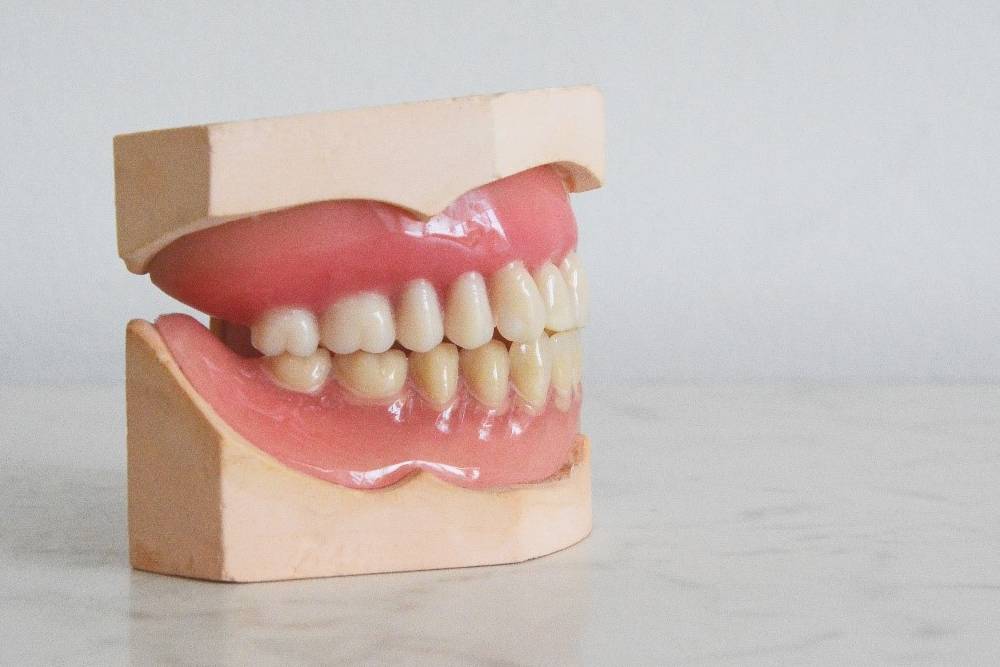 【有影】假牙怎麼選？牙醫師分析4大類 挑對材質才重要