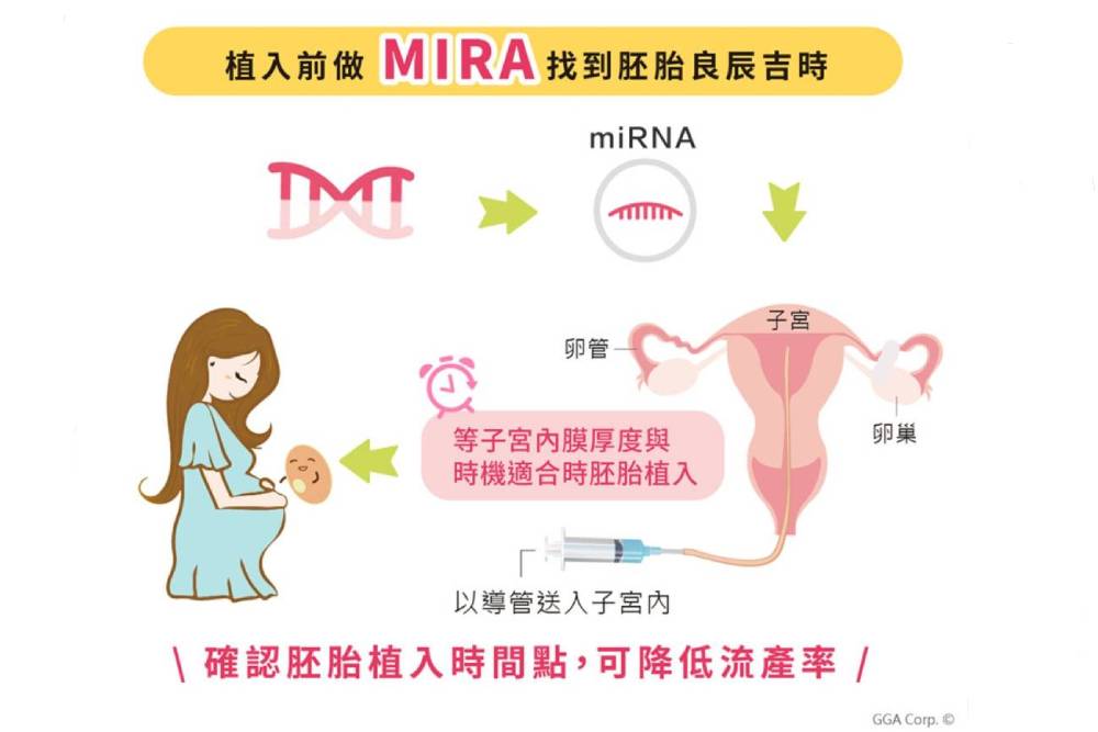 創源-植入MIRA-找到胚胎良辰吉時