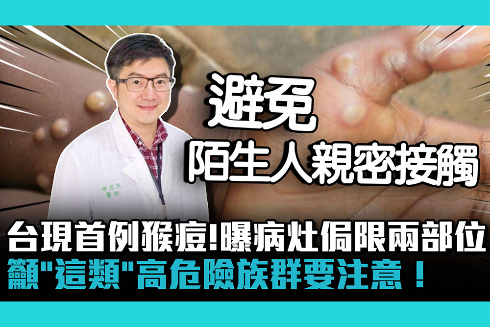 【疫情即時】台灣現首例猴痘！醫師曝病灶侷限「兩部位」    籲「這類」高危險族群要注意！