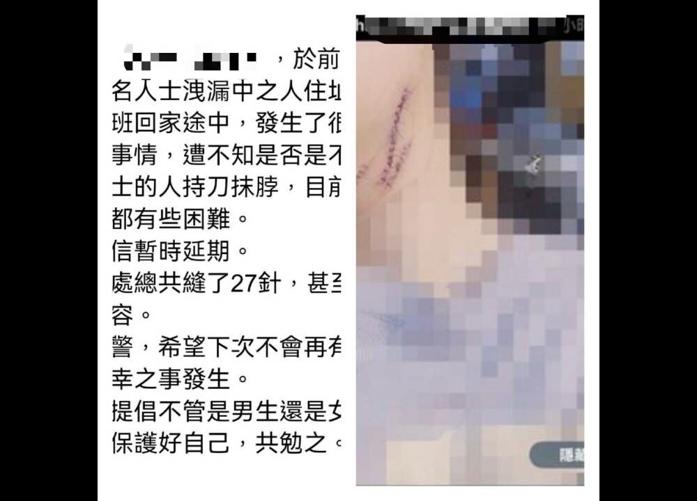 感情糾紛被割喉送醫　24歲女網路貼假文討拍被逮
