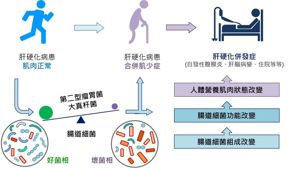 肝硬化病人發生肌少症怪「它」？ 北榮研究揪出三腸道細菌 11