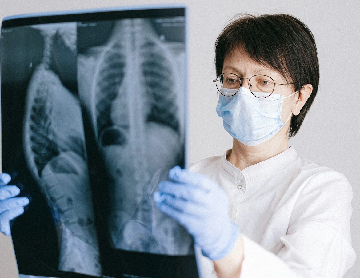 台灣肺癌還有新警訊！   「一族群」10年增9成、平均少活9.7年