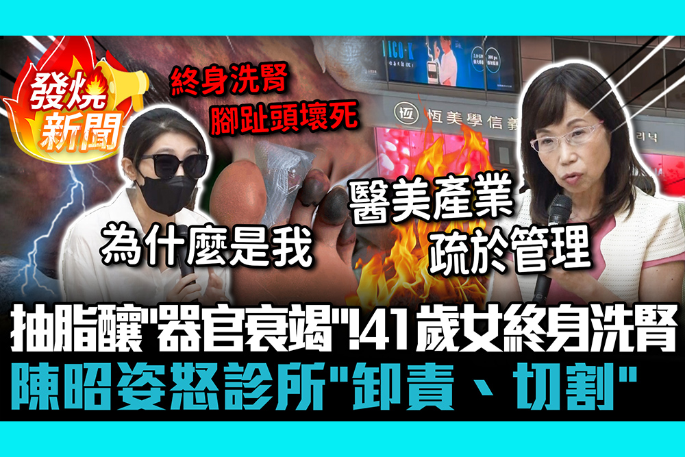 【CNEWS】抽脂回填釀「器官衰竭」！41歲女終身洗腎 陳昭姿怒診所「卸責、切割」醫美淪賺錢工具