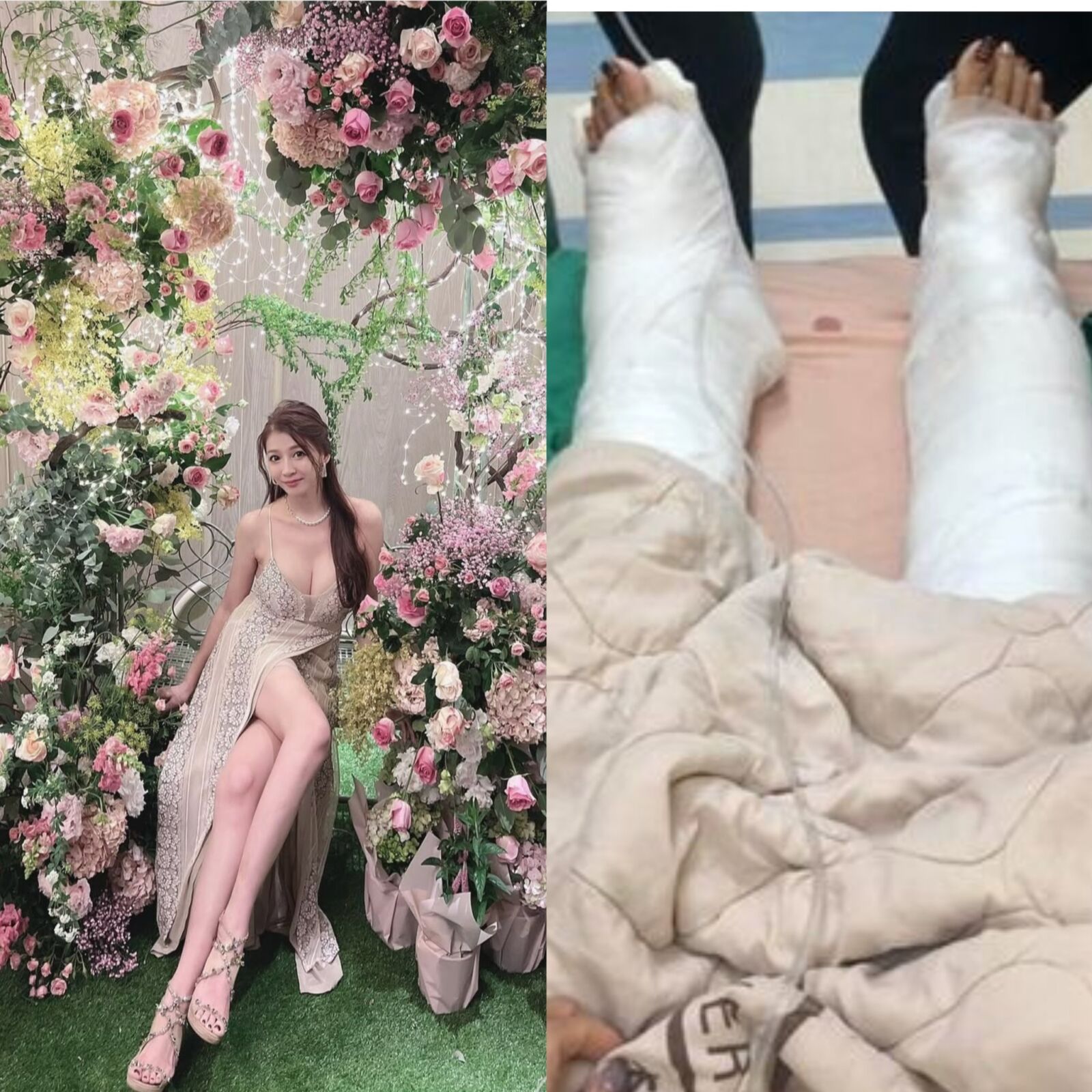 「最美禮生」搭艇出海翻船美腿遭捲螺旋槳 船長挨告最終結果出爐 「最美禮生」搭艇出海翻船美腿遭捲螺旋槳 船長挨告最終結果出爐