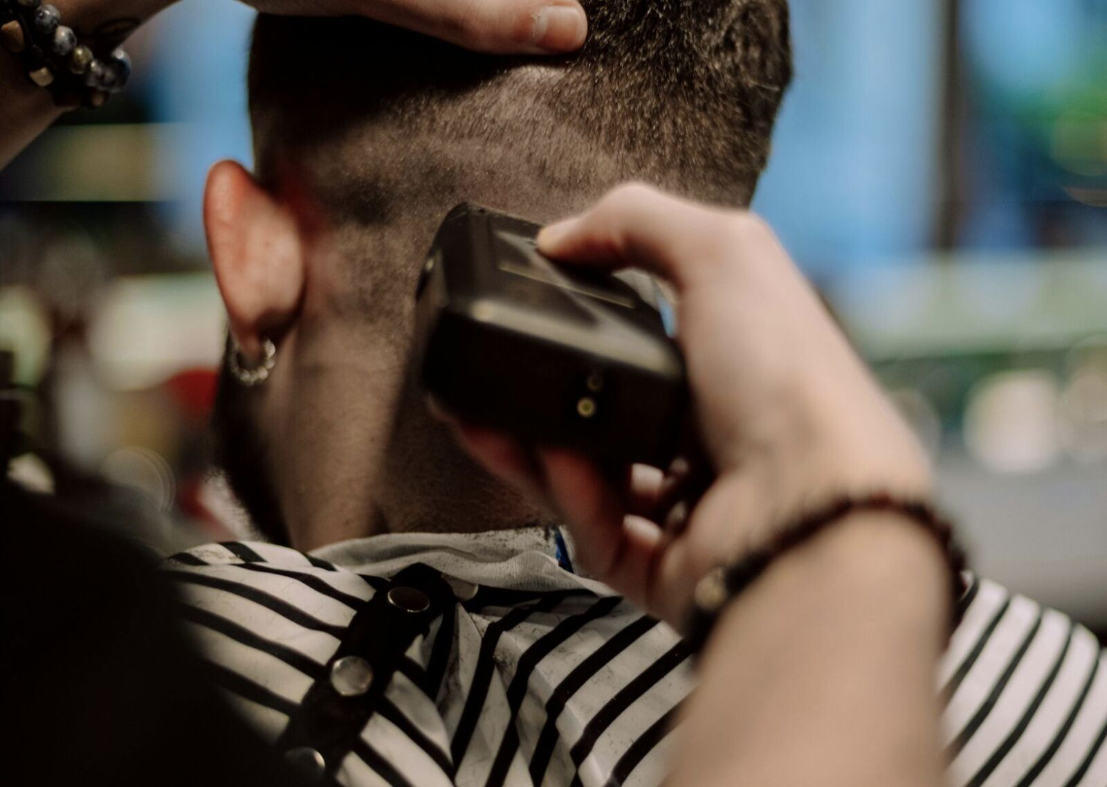 「紅斑、白屑、滲血」三大症狀纏身 乾癬男4年不敢剪髮 1