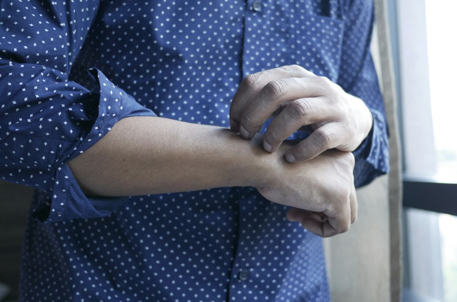 蕁麻疹發作不只皮膚症狀! 她「喉嚨腫脹、呼吸困難」三度送急診 6 蕁麻疹發作不只皮膚症狀! 她「喉嚨腫脹、呼吸困難」三度送急診 5