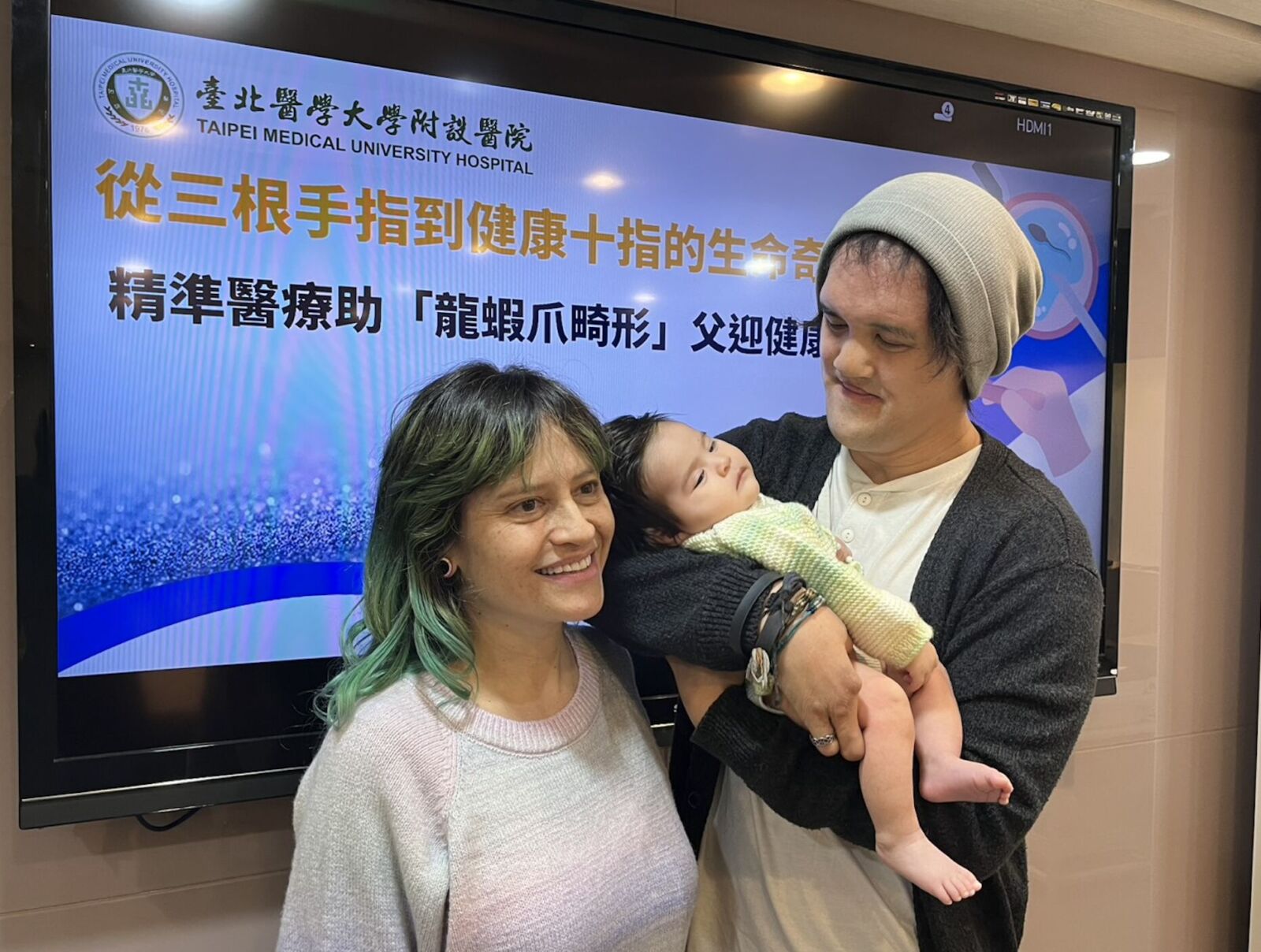 台灣醫療奇蹟 終結罕病遺傳！助「龍蝦爪畸形」父抱回健康女兒 3