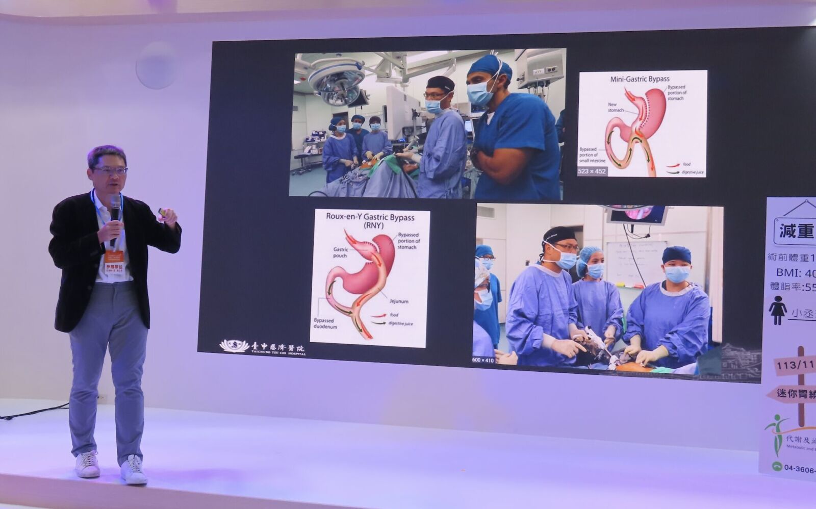 男胖到135公斤險沒命! 胃縮小甩49公斤解除「換心危機」 男胖到135公斤險沒命! 胃縮小甩49公斤解除「換心危機」