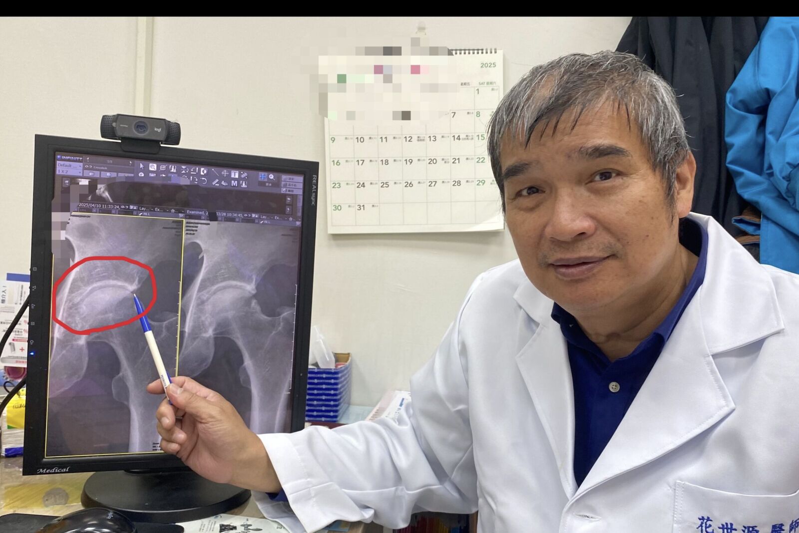 走路沒事「一蹲就痛」？ 長時間深蹲小心髖關節夾擊症候群 7