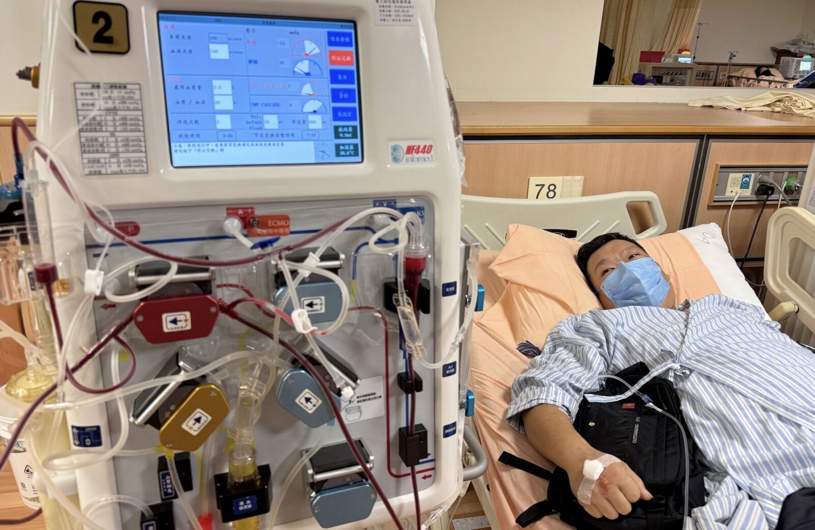 騎機車急煞竟「頭垂垂」無法再抬起！ 男靠「洗血」解危機 3