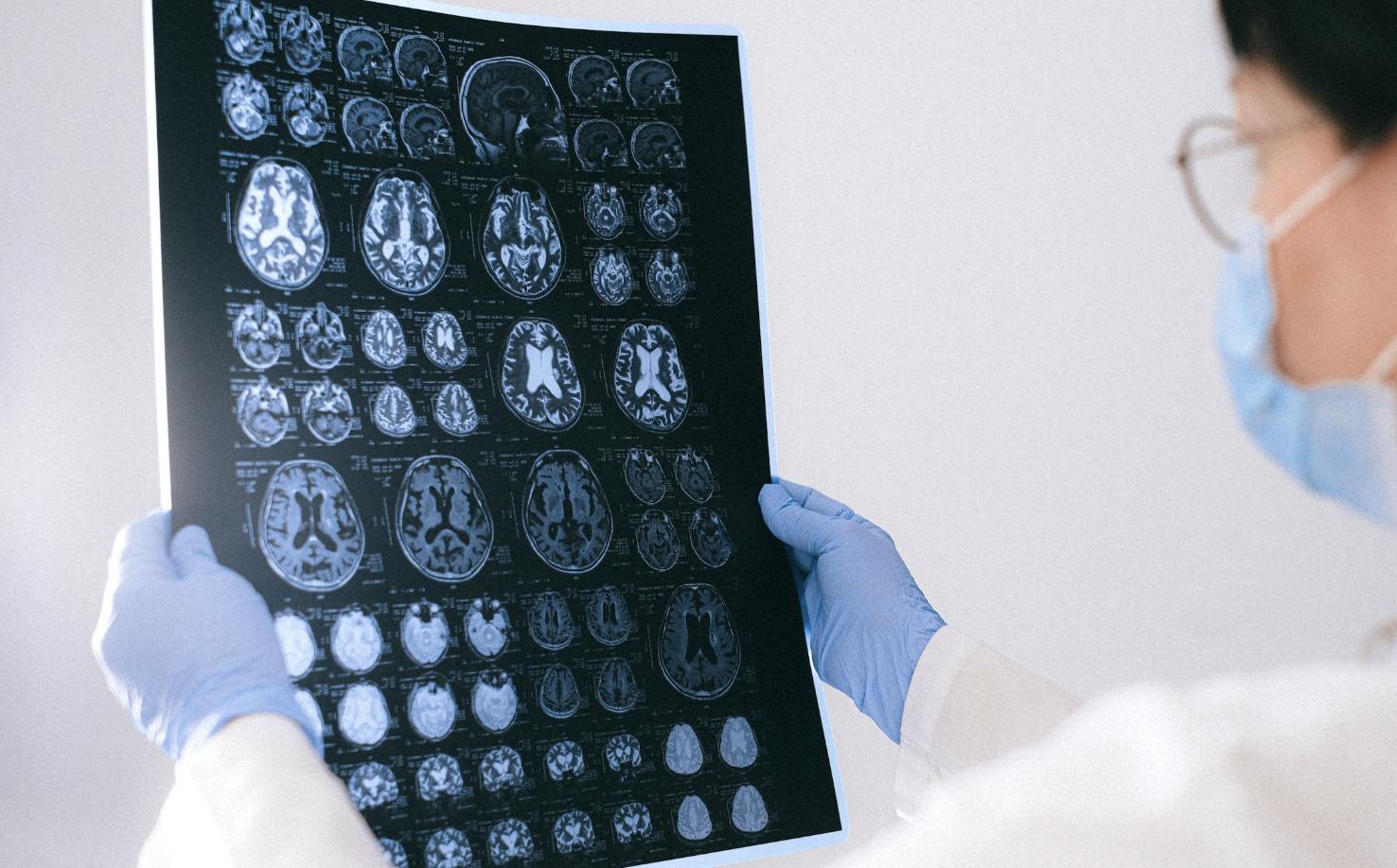 《心腦血管治療的奇蹟》致命的閃靈殺手！心血管疾病大魔王「主動脈剝離」