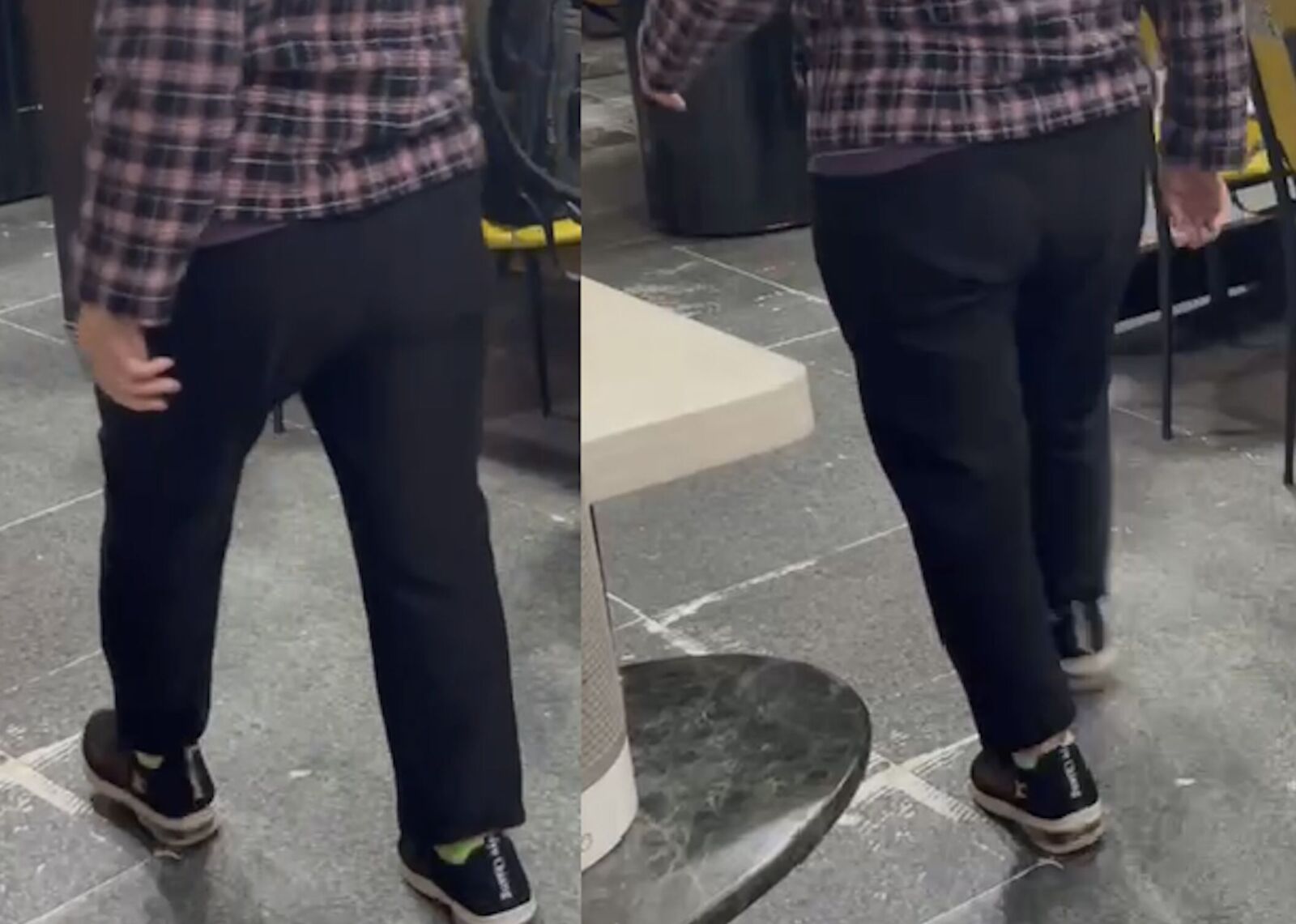 跌倒成老人致命危機！  80歲嬤膝蓋「啪」一聲二度骨折