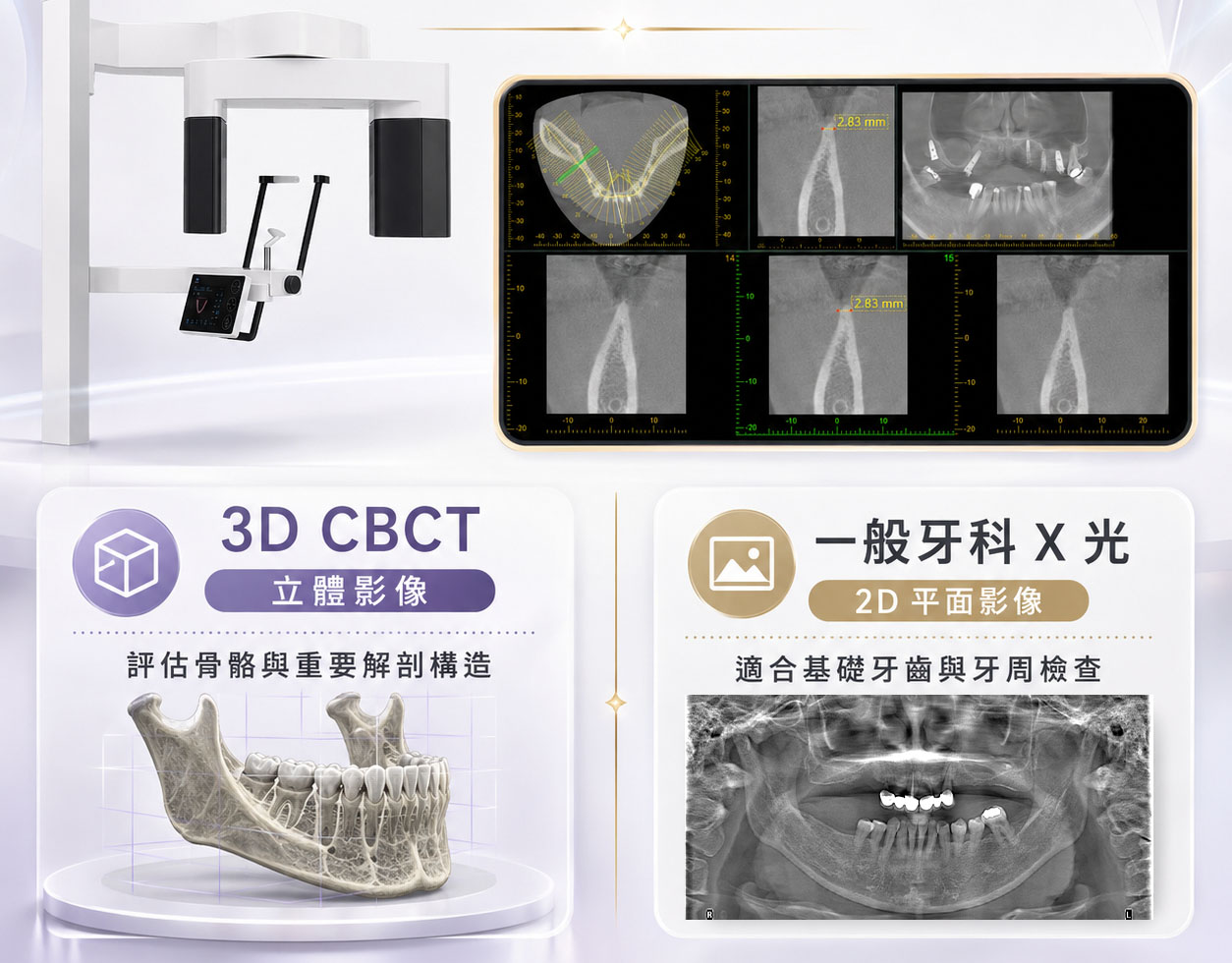 植牙前為何要拍3D影像?骨量、神經與植體位置一次掌握 12 植牙前為何要拍3D影像?骨量、神經與植體位置一次掌握 11