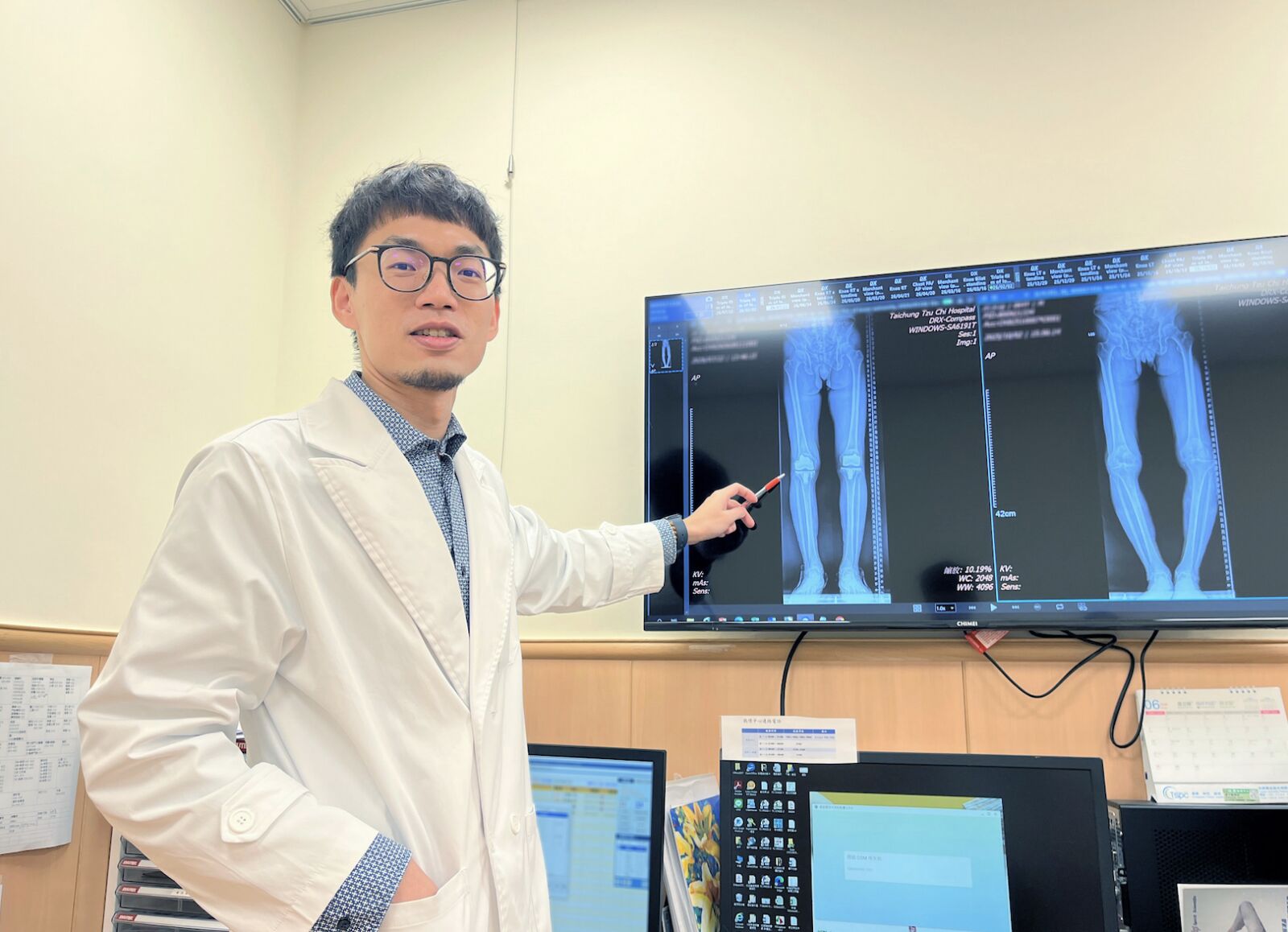 膝蓋僵又痛竟強忍4年   水電工「嚴重變形Ｏ型腿」得換關節