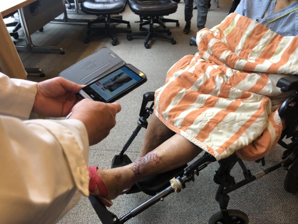 【有影】台大醫院「AI披白袍」揪壞死傷口   手機APP拍張照即搞定
