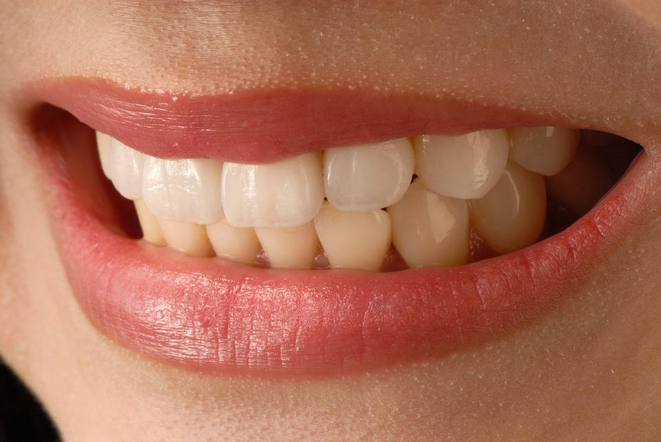 23歲女大生一開口牙骨已流失！  台灣青年型牙周病多歐美十倍