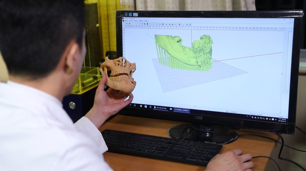 ACOMS在台舉辦 台灣3D列印協助提升手術效率 